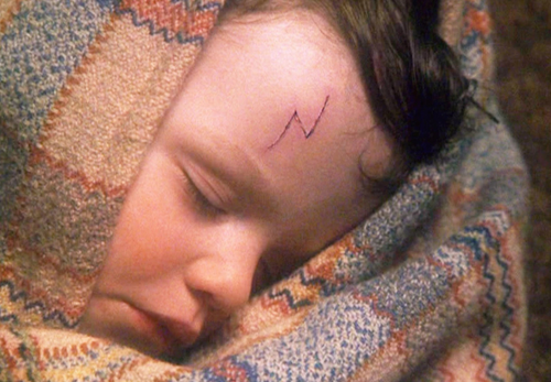 boy asleep with mark on face